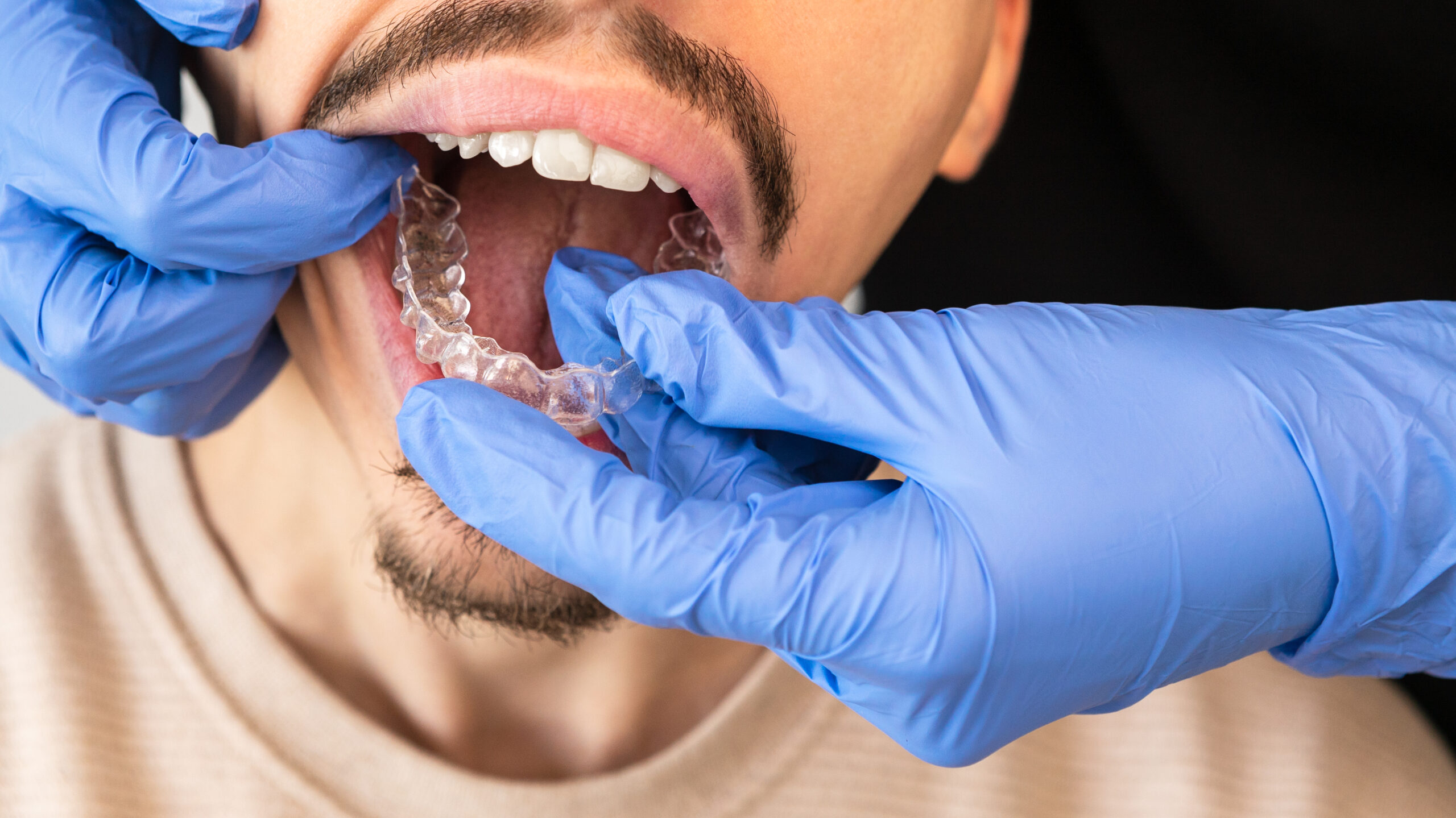 Crafting Perfect Crowns: Innovations in Dental Restoration Techniques